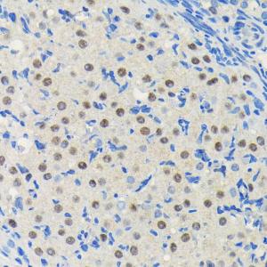 Immunohistochemistry analysis of paraffin-embedded rat ovary using Anti-PIM1 Antibody [ARC0175] (A307510) at a dilution of 1:100 (40x lens) Perform microwave antigen retrieval with 10 mM PBS buffer pH 72 before commencing with IHC staining protocol