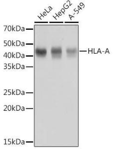 Western blot analysis of extracts of various cell lines, using Anti-HLA-A Antibody [ARC0588] (A81042) at 1:1,000 dilution The secondary antibody was Goat Anti-Rabbit IgG H&L Antibody (HRP) at 1:10,000 dilution Lysates/proteins were present at 25 µg per lane