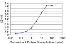 Anti-TAF11 Mouse Monoclonal Antibody [clone: 3H5]