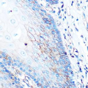 Immunohistochemistry analysis of paraffin-embedded human esophageal using Anti-HLA-A Antibody [ARC0588] (A81042) at a dilution of 1:100 (40x lens) Perform microwave antigen retrieval with 10 mM PBS buffer pH 72 before commencing with IHC staining protocol