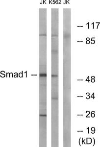 Anti-Smad1 antibody