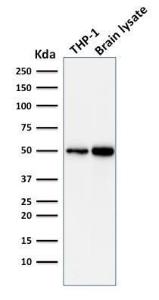 Anti-ATG5 antibody