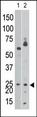 Anti-BNIP3 (NIP3) Rabbit Polyclonal Antibody