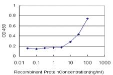 Anti-FZD3 Mouse Monoclonal Antibody [clone: 2H5]