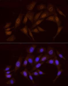 Immunofluorescence analysis of NIH/3T3 cells using Anti-Chk1 Antibody (A10183) at a dilution of 1:20 (40X lens). DAPI was used to stain the cell nuclei (blue)