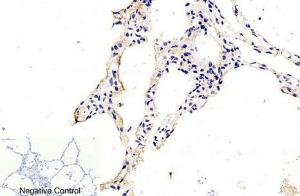 Immunohistochemical analysis of paraffin-embedded human lung tissue using Anti-Caspase 9 (cleaved Asp315) Antibody at 1:200 (4°C overnight) Negative control was secondary antibody only