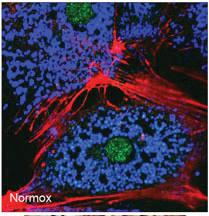 Anti-BNIP3 (NIP3) Rabbit Polyclonal Antibody