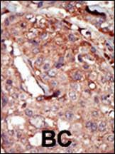 Anti-BRD2 Rabbit Polyclonal Antibody (PE (Phycoerythrin))