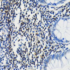 Immunohistochemistry analysis of paraffin-embedded human colon tissue using Anti-PIM1 Antibody [ARC0175] (A307510) at a dilution of 1:100 (40x lens) Perform microwave antigen retrieval with 10 mM PBS buffer pH 72 before commencing with IHC staining protocol