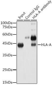 Immunoprecipitation analysis of 300 µg extracts of HeLa cells using 3 µg of Anti-HLA-A Antibody [ARC0588] (A81042) This Western blot was performed on the immunoprecipitate using Anti-HLA-A Antibody [ARC0588] (A81042) at a dilution of 1:2000