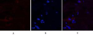 Immunofluorescence analysis of human breast tissue using Anti-Caspase 9 (cleaved Asp315) Antibody (red) at 1:200 (4°C overnight) Cy3 labelled secondary antibody was used at 1:300 (RT 50min) Panel A: Target Panel B: DAPI Panel C: Merge