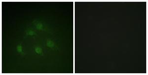 Anti-Smad1 antibody