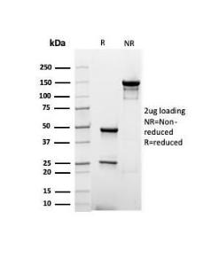 Antibody anti-albumin RALB6414 100 µg