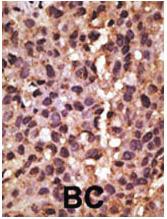 Anti-BNIP3 (NIP3) Rabbit Polyclonal Antibody