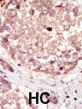 Anti-HIPK3 Rabbit Polyclonal Antibody