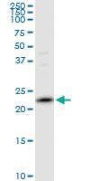 Anti-PRDX2 Mouse Polyclonal Antibody