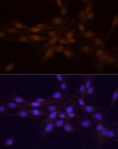 Immunofluorescence analysis of PC-12 cells using Anti-Chk1 Antibody (A10183) at a dilution of 1:20 (40X lens). DAPI was used to stain the cell nuclei (blue)