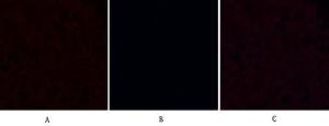 Immunofluorescence analysis of human breast tissue using Anti-Caspase 9 (cleaved Asp315) Antibody (red) at 1:200 (4°C overnight) Cy3 labelled secondary antibody was used at 1:300 (RT 50min) Panel A: Target Panel B: DAPI Panel C: Merge