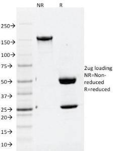 Anti-ATG5 antibody