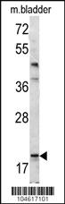 Anti-BAD Rabbit Polyclonal Antibody