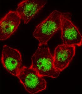 Anti-CDKN1C Rabbit Polyclonal Antibody (Biotin)