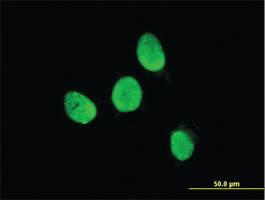 Anti-TESK2 Mouse Monoclonal Antibody [clone: 5G1]