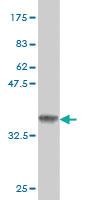 Anti-MECOM Mouse Monoclonal Antibody [clone: 6A9]