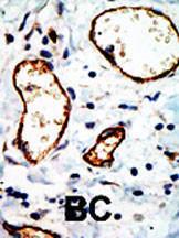 Anti-NCOR1 Rabbit Polyclonal Antibody