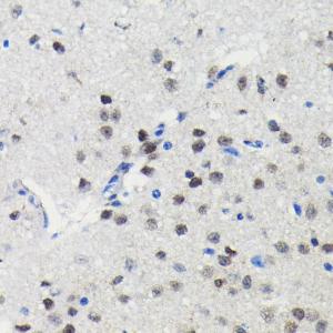 Immunohistochemistry analysis of paraffin-embedded mouse brain using Anti-PIM1 Antibody [ARC0175] (A307510) at a dilution of 1:100 (40x lens) Perform microwave antigen retrieval with 10 mM PBS buffer pH 72 before commencing with IHC staining protocol