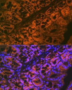 Immunofluorescence analysis of mouse large intestine using Anti-ADAM15 Antibody [ARC1419] (A308455) at a dilution of 1:100 (40X lens). DAPI was used to stain the cell nuclei (blue)