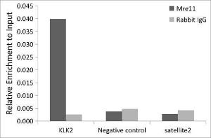 Chromatin immunoprecipitation (ChIP) analysis of extracts of LNCaP cells, using Anti-Mre11 Antibody [ARC0931] (A308456) and Rabbit IgG. The amount of immunoprecipitated DNA was checked by quantitative PCR. Histogram was constructed by the ratios of the immunoprecipitated DNA to the input