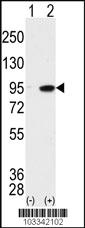 Anti-MAK Rabbit Polyclonal Antibody