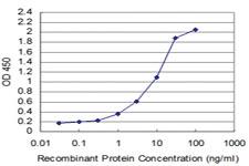 Anti-TESK2 Mouse Monoclonal Antibody [clone: 5G1]