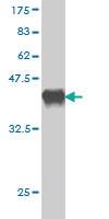 Anti-BMP2K Mouse Monoclonal Antibody [clone: X1]