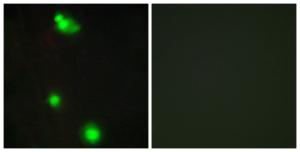 Immunofluorescence analysis of MCF7 cells using Anti-SFRS3 Antibody. The right hand panel represents a negative control, where the Antibody was pre-incubated with the immunising peptide