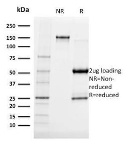 SDS-PAGE analysis of Anti-Albumin Antibody [ALB/2141] under non-reduced and reduced conditions; showing intact IgG and intact heavy and light chains, respectively. SDS-PAGE analysis confirms the integrity and purity of the antibody