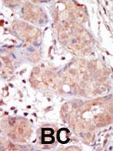 Anti-MAK Rabbit Polyclonal Antibody