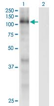 Anti-RBL1 Mouse Monoclonal Antibody [clone: 1A5]