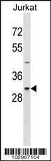 Anti-NEK7 Rabbit Polyclonal Antibody (Biotin)