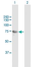 Anti-DHX58 Rabbit Polyclonal Antibody