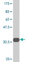 Anti-VAMP5 Mouse Monoclonal Antibody [clone: 3D4]