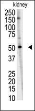 Anti-RNF216 Rabbit Polyclonal Antibody (AP (Alkaline Phosphatase))