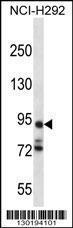 Anti-PCDHA7 Rabbit Polyclonal Antibody (HRP (Horseradish Peroxidase))