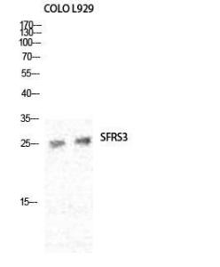 Western blot analysis of various cells using Anti-SFRS3 Antibody