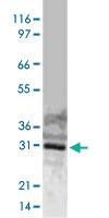 Anti-BIRC7 Rabbit Polyclonal Antibody