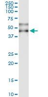 Anti-SERPINA3 Polyclonal Antibody Pair