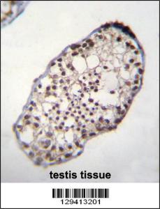 Anti-TSGA10IP Rabbit Polyclonal Antibody (HRP (Horseradish Peroxidase))