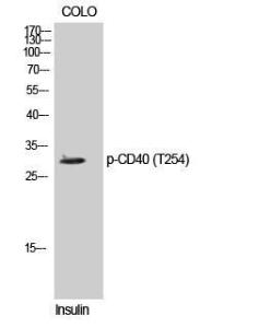 Western blot analysis of COLO cells using Anti-TNFRSF5 (phospho Thr254) Antibody