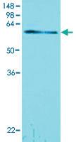 Anti-TDP1 Mouse Monoclonal Antibody [clone: AT1F2]