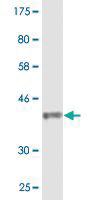 Anti-CACNA2D2 Mouse Monoclonal Antibody [clone: 3A4]